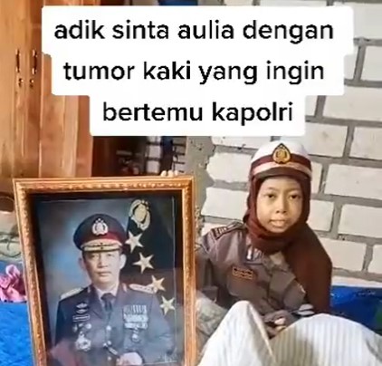 Kapolri Merespons Permintaan Sinta Aulia, Anak Penderita Tumor Kaki